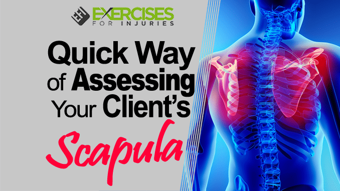 Quick Way of Assessing Your Client’s Scapula copy