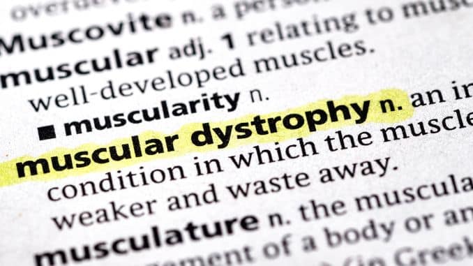 Effective Muscular Dystrophy Exercises to Improve Strength, Flexibility & Daily Function- muscular dystrophy exercises