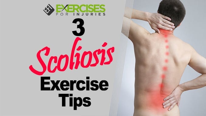 3 Scoliosis Exercise Tips