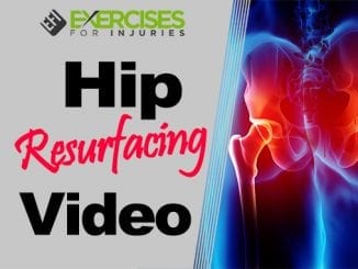 Hip Resurfacing Video