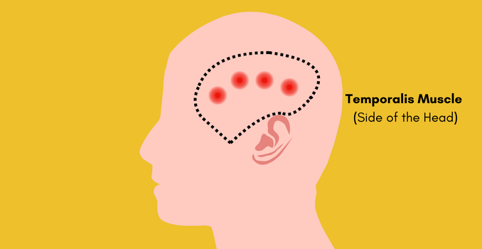 Temporalis Muscle