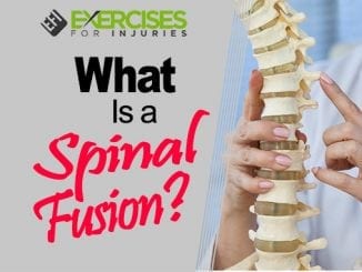 What is a Spinal Fusion