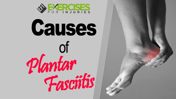 Causes of Plantar Fasciitis