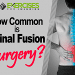 How Common is Spinal Fusion Surgery?