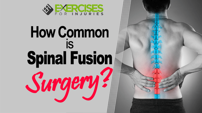 How Common is Spinal Fusion Surgery