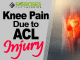 Knee Pain Due to ACL Injury
