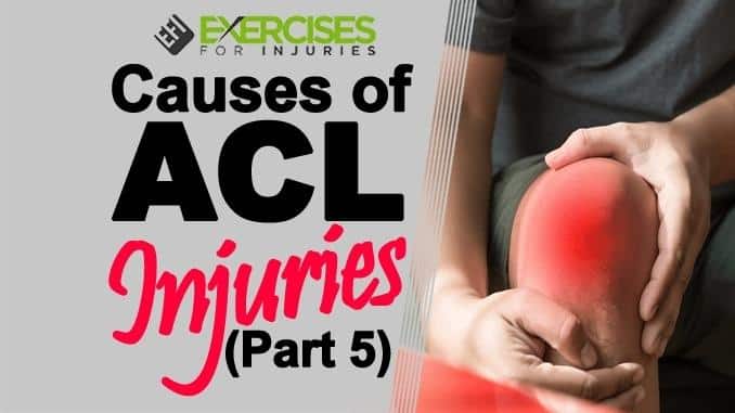 Causes-of-ACL-Injuries