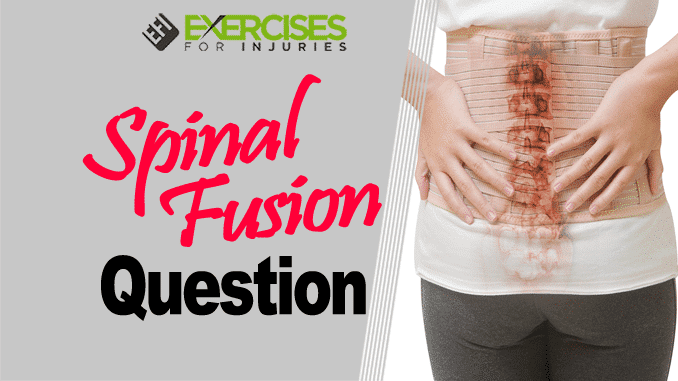 Spinal Fusion Question
