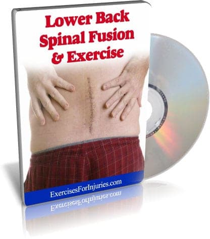 Lower Back Spinal Fusion Exercise Program