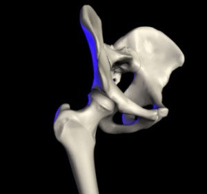 Hip-Pain