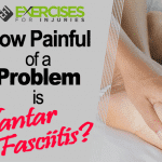 How Painful of a Problem is Plantar Fasciitis?