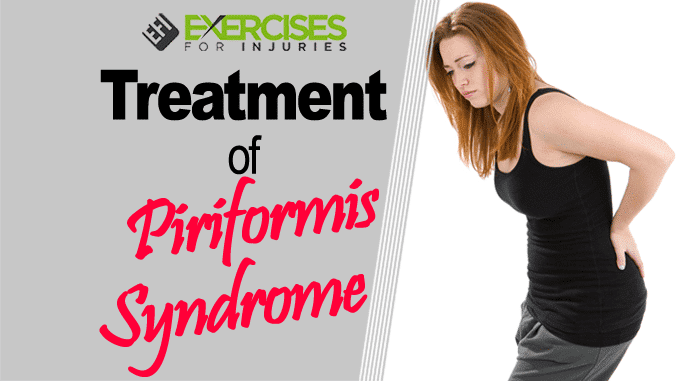 Treatment of Piriformis Syndrome