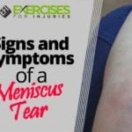 Signs and Symptoms of a Meniscus Tear