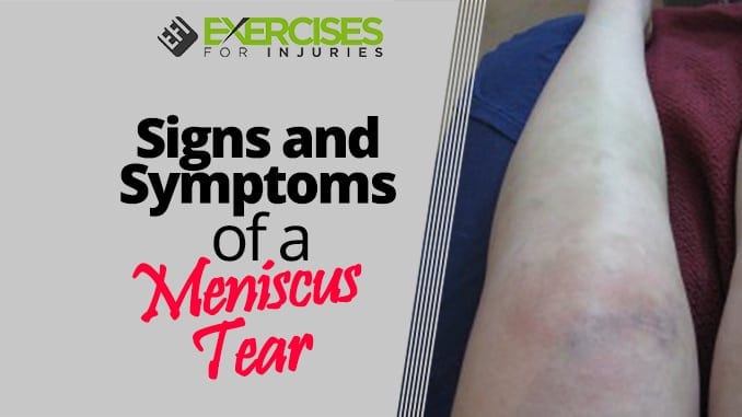 Signs and Symptoms of a Meniscus Tear