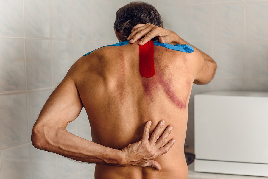 Rear Photo Of Young Man Having Back Pain Caused By Trigger Point