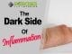 The Dark Side of Inflammation