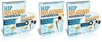 hip replacement handbook