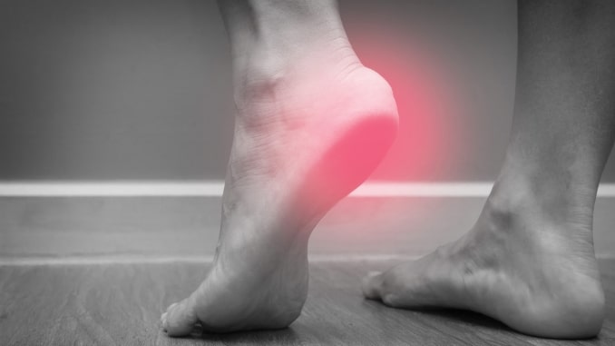 What Can You Do for Your Plantar Fasciitis?