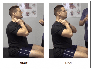 Forward Head Posture Massage - Exercises For Injuries