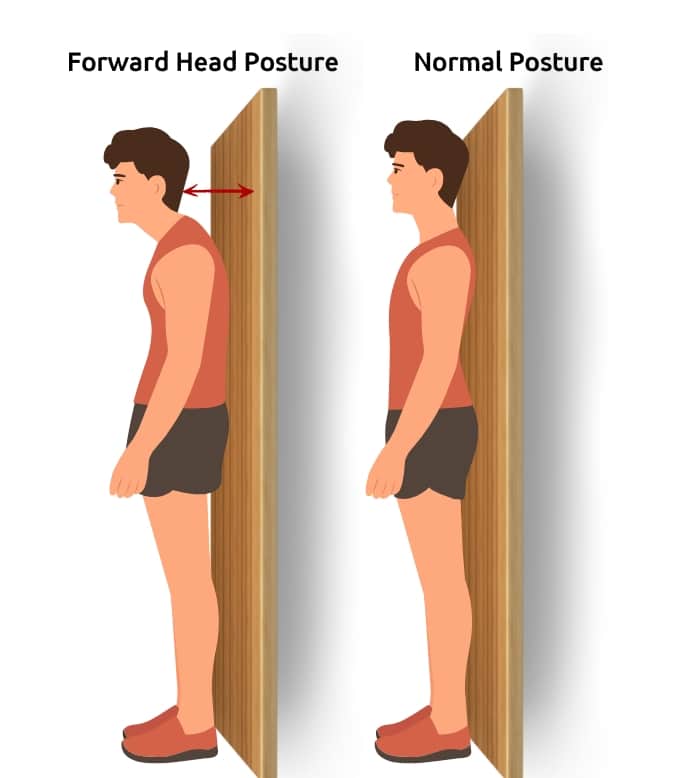 Forward vs Normal