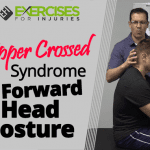 Upper Crossed Syndrome & Forward Head Posture