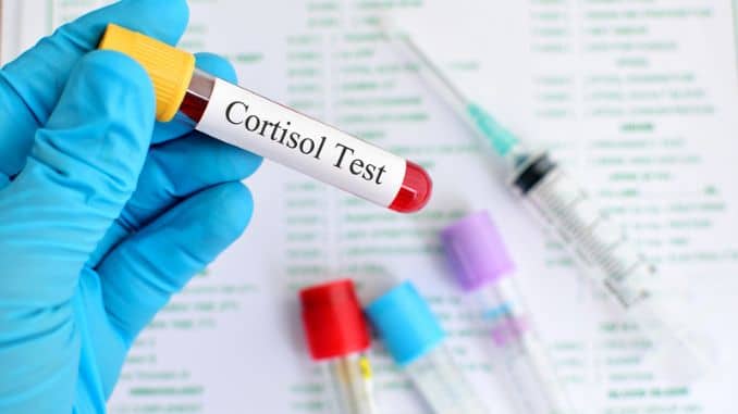 cortisol test