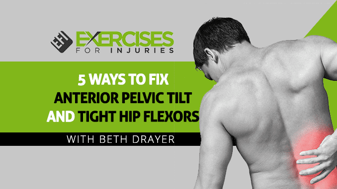 5 Ways to Fix Anterior Pelvic Tilt and Tight Hip Flexors