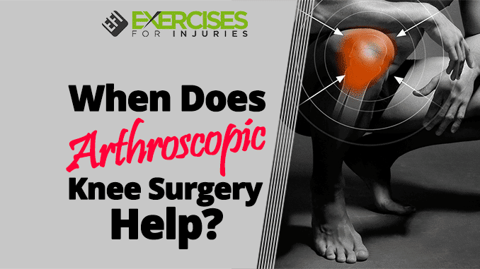 When Does Arthroscopic Knee Surgery Help