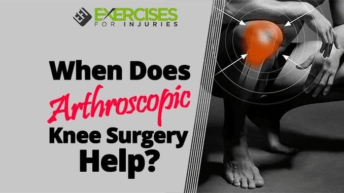 When-Does-Arthroscopic-Knee-Surgery-Help
