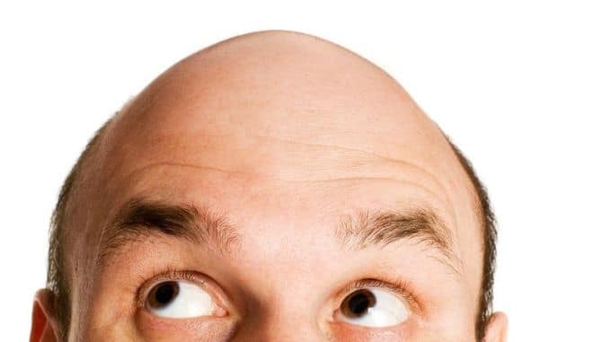 bald-head-looking-up