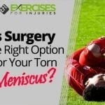 Is Surgery the Right Option for Your Torn Meniscus?
