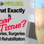 What Exactly is Scar Tissue? Injuries, Surgeries and Rehabilitation