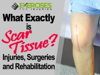 What-Exactly-is-Scar-Tissue-Injuries-Surgeries-and-Rehabilitation
