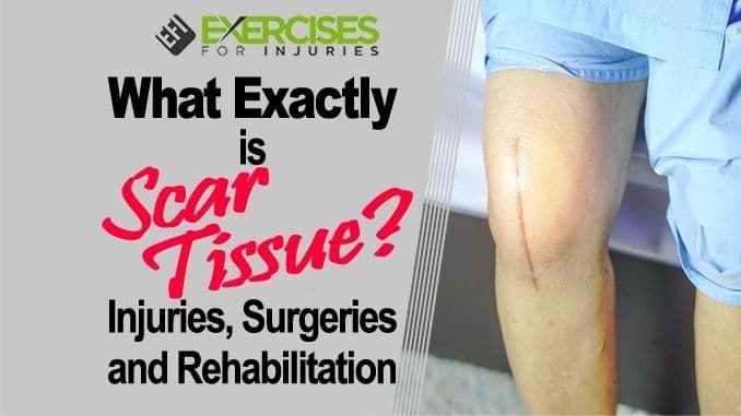 What-Exactly-is-Scar-Tissue-Injuries-Surgeries-and-Rehabilitation