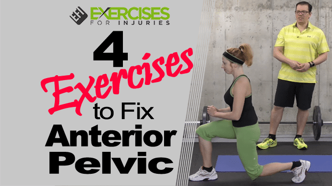 4 Exercises to Fix Anterior Pelvic Tilt