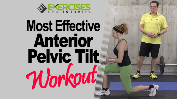 4 Exercises to Fix Anterior Pelvic Tilt