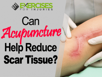 Can Acupuncture Help Reduce Scar Tissue