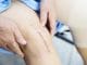 Knee Replacements - Benefits, Risks & Recovery