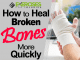 How to Heal Broken Bones More Quickly