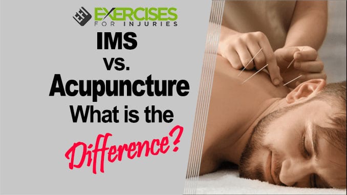 IMS vs. Acupuncture — What Is the Difference