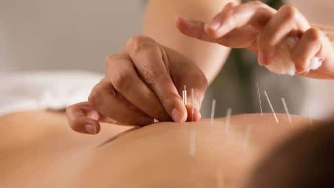 body-on-the-acupuncture