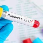 Natural Ways to Treat Norovirus (Stomach Flu)