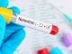 Natural Ways to Treat Norovirus (Stomach Flu)