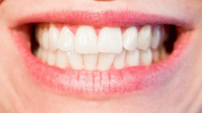 teeth-dentist-dental-mouth