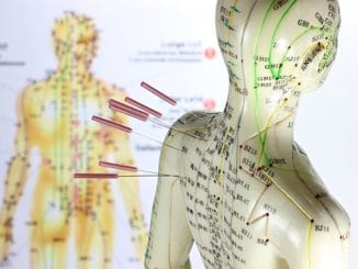 Should You Try Acupuncture