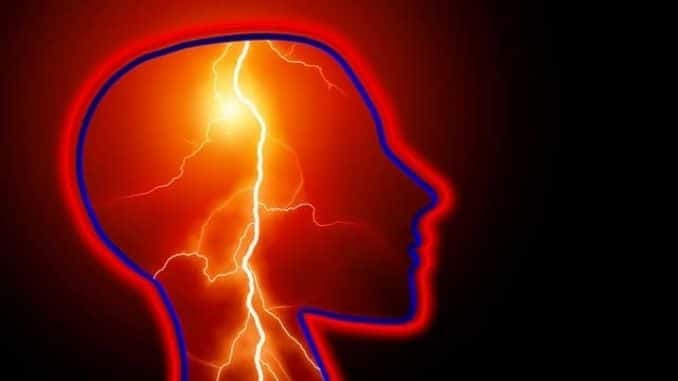 seizure-stroke-headache