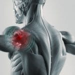 Ask EFI – How Do I Relieve Shoulder Pain Caused by Biceps Tendonitis