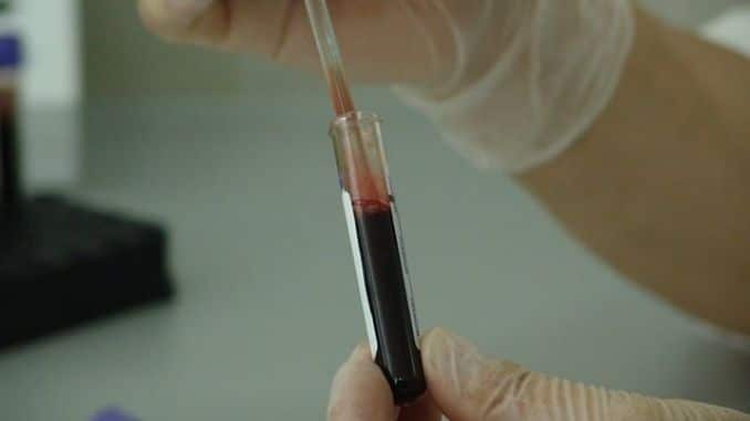 blood-vial-analysis