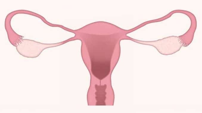 uterus-ovaries-gynecology - Typical and Unusual Symptoms of Menopause