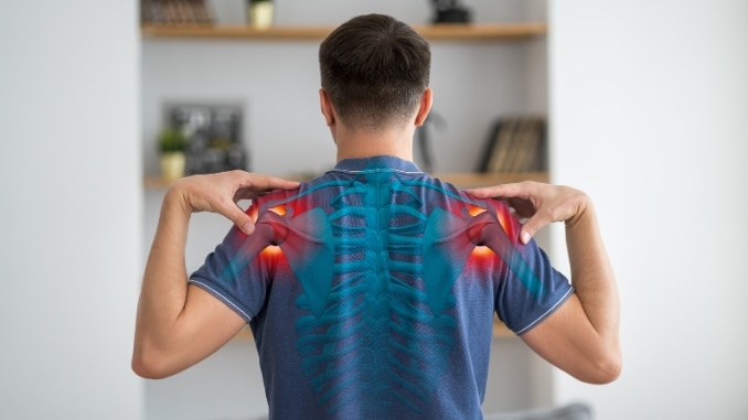 How to Treat Frozen Shoulder Syndrome